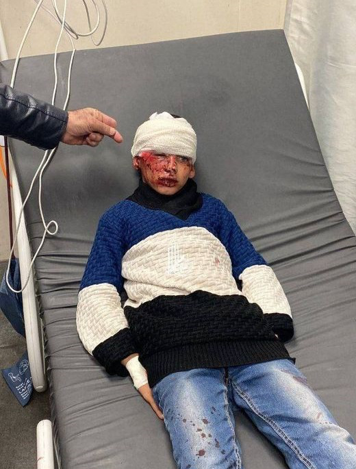 إصابة طفل في اعتداء للمستوطنين بالخليل
